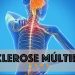 Avaré terá o primeiro evento sobre Esclerose Múltipla nesta quinta-feira (29)