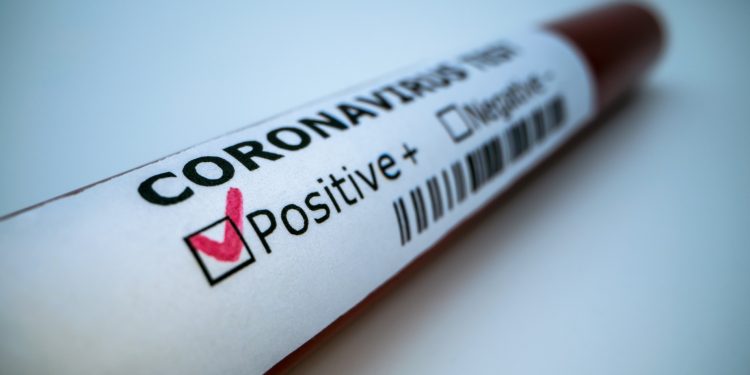 Sorocaba confirma mais duas mortes por Covid-19 no ano