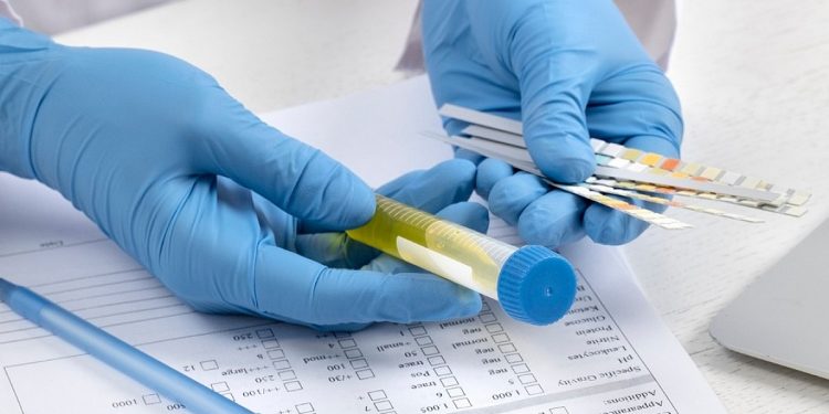 Arraiá no posto Brabância conscientiza sobre hepatites virais nesta quarta, 30