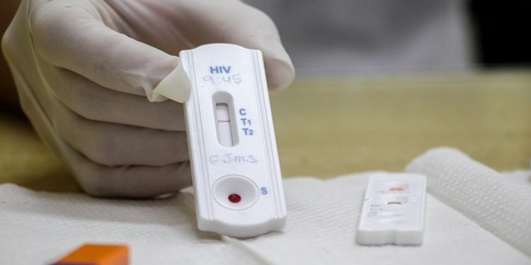 Postos de saúde oferecem testes rápidos de HIV, sífilis e hepatites virais