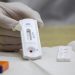 Postos de saúde oferecem testes rápidos de HIV, sífilis e hepatites virais